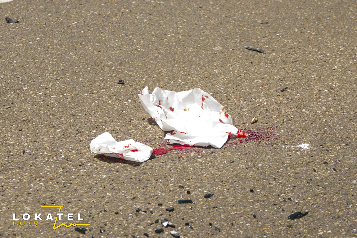Scooterbestuurder gewond na botsing met auto in Scheveningen